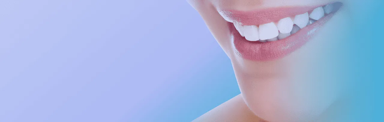 Albire dentară - Estetică dentară