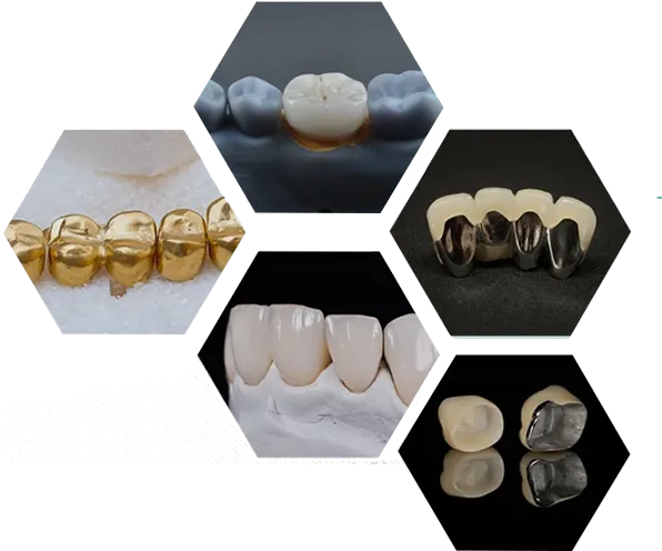 Coroane dentare