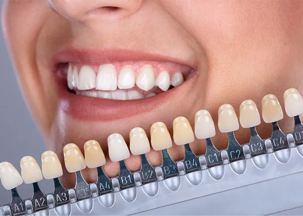 Tratamente de estetică dentară